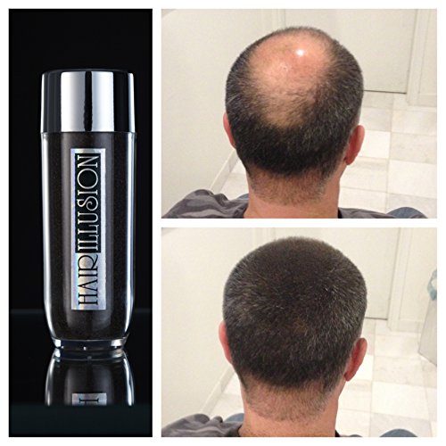 HAIR ILLUSION - 100% Natural Real Human Hair FibersNot Synthetic For Men & Women,Premium Hair Building Formulation, ~ LARGE 38g Bottle (dark brown)