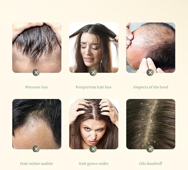 ANTI HAIR LOSS PLANT SHAMPOO, GINGER PLANT EXTRACT FOR HAIR GROWTH,OIL CONTROL, HAIR CARE FOR WOMEN,MEN (200G/BOX)