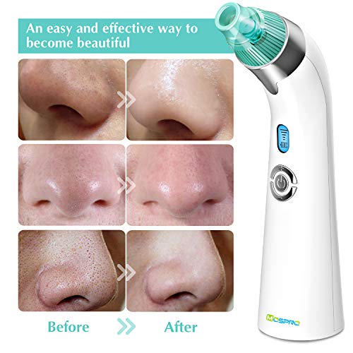 5 Blackhead+Remover+Vacuum+Pore+Cleaner
