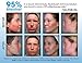 Acne Treatment Gel with 2% Mandelic Acid & 2% Salicylic Acid - Severe Acne Serum, Scar & Spot Treatment for Face (90 Day)