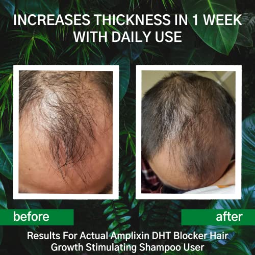 DHT Blocker Hair Growth Shampoo Clinically Proven Hair Loss & Healthy Hair Regrowth Shampoo