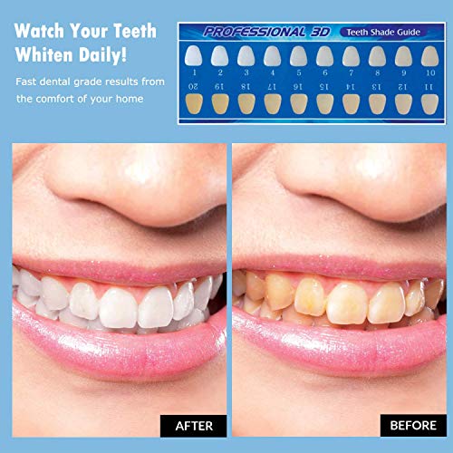 Teeth Whitening Kit, Potok Teeth Whitening Set Professional Reusable Teeth Whitening for White Teeth, Whitening Teeth At Home, 10xToothing Gel, 2x Dental Trays Gel Kit, 1x Laser Light - Thumbnail 2