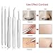 MiroPure Blackhead Whitehead & Splinter Remover
