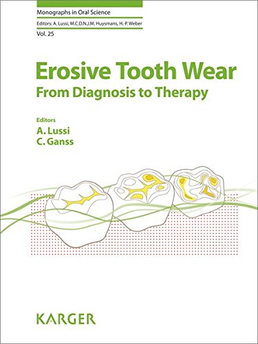 Download Erosive Tooth Wear: From Diagnosis to Therapy (Monographs in Oral Science, Vol. 25)