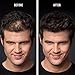 Premium Hair Thickening Fibers for Women & Men | 0.97 oz (Black)