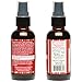 Shea Terra Rose Hips and Carrot Perfecting Serum | Nutrient Rich, All Natural & Organic Oil with Anti-Aging Vitamin A, E and Beta-Carotene for Clear and Glowing Youthful Skin – 2 oz