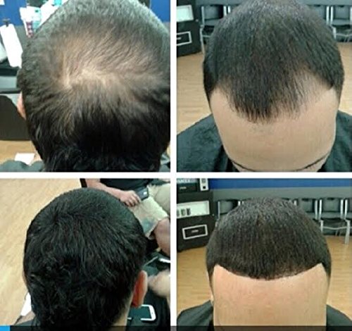 HAIR ILLUSION - 100% Natural Real Human Hair FibersNot Synthetic For Men & Women,Premium Hair Building Formulation, ~ LARGE 38g Bottle (dark brown)