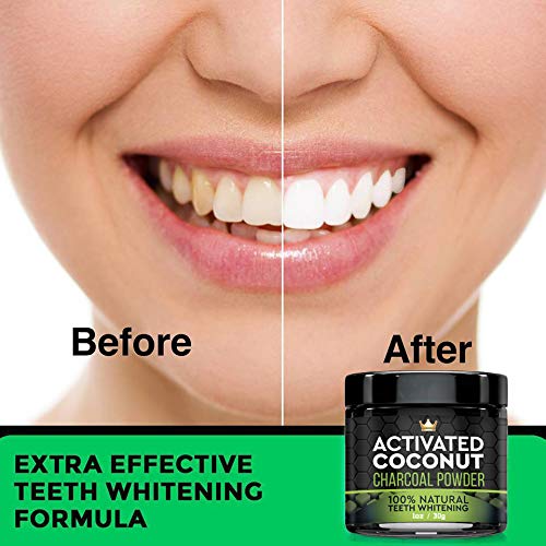 Natural Charcoal Teeth Whitening Powder - Coconut Activated Charcoal - Best Tooth Whitener For Sensitive Teeth - Naturally Whitens Teeth - mint flavor for fresh breath