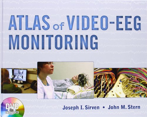 ATLAS OF VIDEO-EEG MONITORING