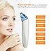 Blackhead Remover, Imbeang Blackhead Vacuum Suction Remover Electric Facial Pore Cleanser with Microcrystalline Head Electric Skin Cleaner Blackhead Extraction Tool,1 Set of 4 Tips
