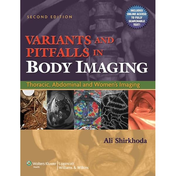健康・医学 Meyers' Dynamic Radiology of the Abdomen Dynamic Radiology of the Abdomen: Normal and Pathologic Anatomy