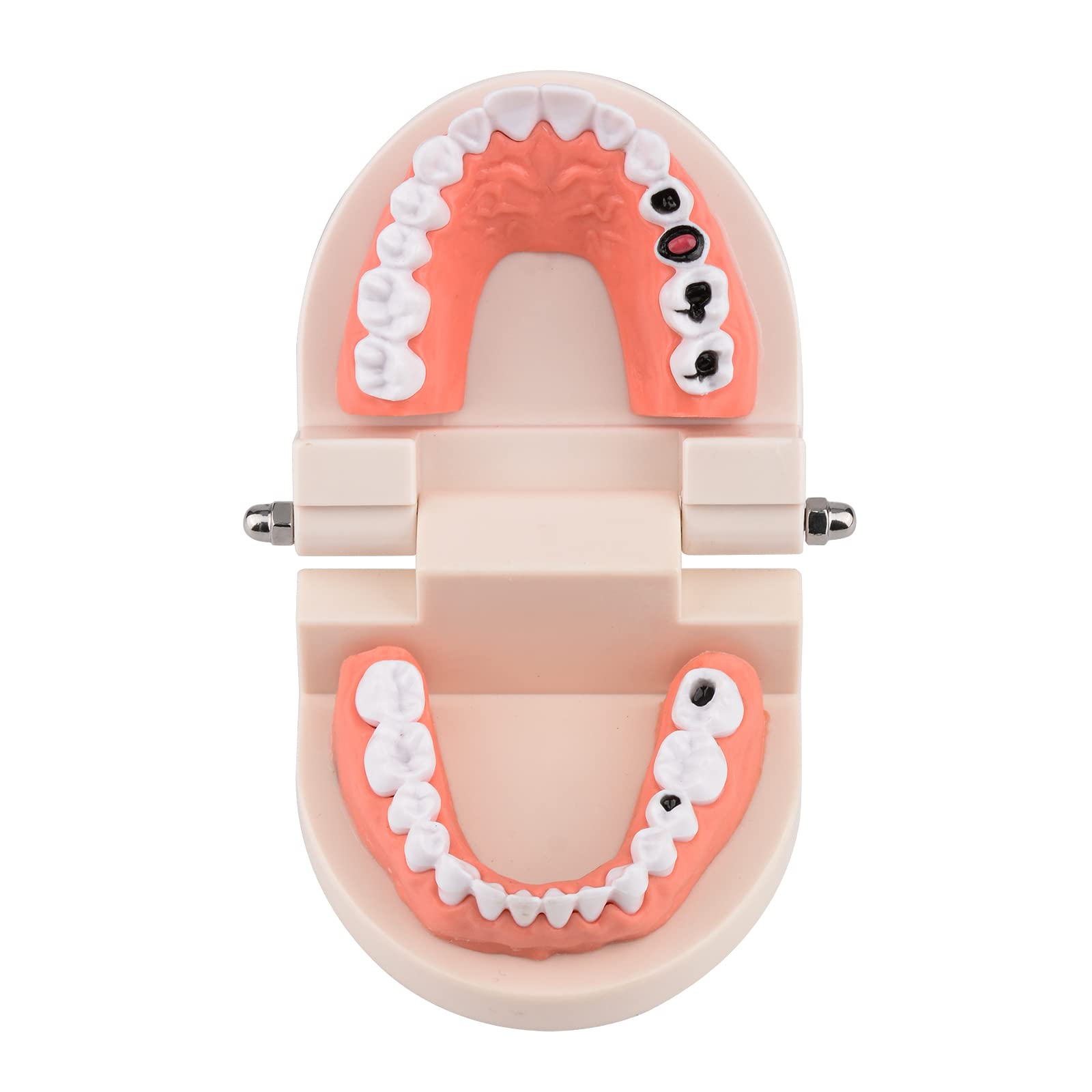 Mua Ultrassist Dental Caries Study Model, 1:1 Life Size Fake Adult ...