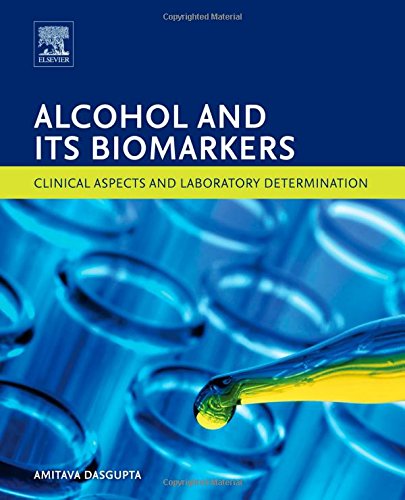 Alcohol and Its Biomarkers: Clinical Aspects and Laboratory Determination (Clinical Aspects and Laboratory Determination of Biomarkers)