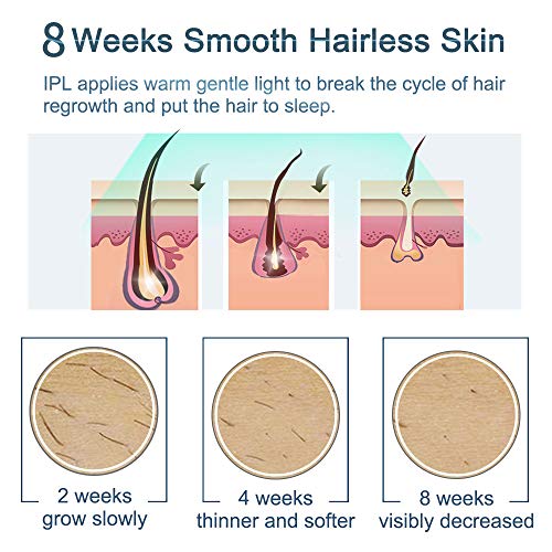 IPL Hair Removal Device Veme 500000 Flashes ICE Cooling Home Use Hair Remover for Face, Armpits, Bikini Line, Legs