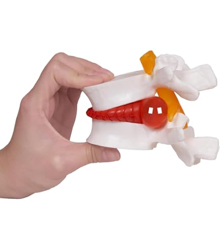 Amazon.com: HEMIPLEGIA Model Educational Model Occiput Model