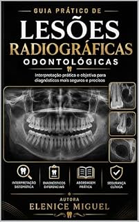 Livro GUIA PRÁTICO DE: LESÕES RADIOGRÁFICAS ODONTOLÓGICAS: Interpretação prática e objetiva para diagnósticos mais seguros e precisos