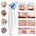 Blackhead Remover Pore Vacuum - Upgrade #1 Blackhead Vacuum Electric Skin Pore Cleaner Comedone Extractor for Men and Women