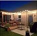 25FT Outdoor G40 Globe String Lights, Vintage Backyard Patio Lights with 25 Clear Bulbs, for Indoor/Outdoor Use, Globe Hanging Light String for Wedding Party Bistro Cafe Deck Pergola Decor