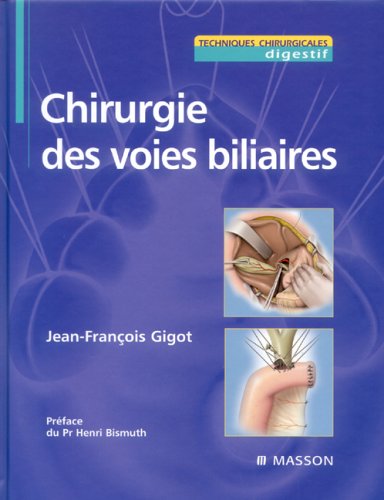 Chirurgie des voies biliaires