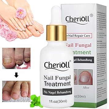 Buy Cherioll Nail Fungus Oil Natural Anti Fungal Nail Treatment Anti Fungal Mushroom Solution With Pure Essential Oils Yellow By Infizierten Finger Online At Low Prices In India Amazon In