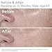 SkinMedica HA5 Rejuvenating Hydrator. Hyaluronic Acid Serum for Face with Five Types of Hyaluronic Acid that Smooth Fine Lines and Wrinkles, For All Skin Types, 1 Oz
