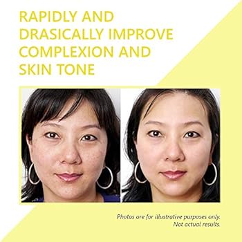 hydroquinone skin lightener & dark spot corrector