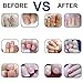 Fungus Treatment Cream,Nail Fungus Cream,Foot Fungus,Fungus Stop,Anti fungal Nail,Restores The Healthy Appearance of Nails Discolored or Damaged by Nail Fungus…