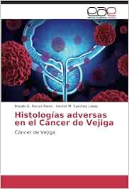 Histologías adversas en el Cáncer de Vejiga: Cáncer de Vejiga