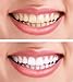Mia Adora Teeth Whitening Activated Charcoal with Coconut - Natural Teeth Whitening at Home - Mint Flavor - Snow Effect