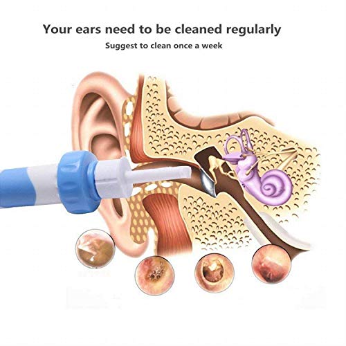 Portable Automatic Electric Vacuum Ear Wax Earwax Removal Tool Kit, Ear Vacuum Cleaner Easy Earwax Remover Soft Prevent Ear-Pick Clean Tools Set for Adults Kids