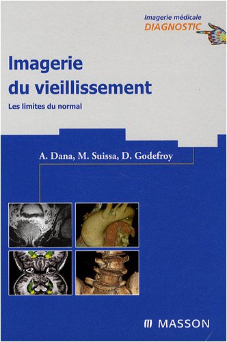 Imagerie du vieillissement