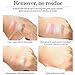 MISKOS 12 Colors Bright Pink Natural Eyeshadow Palette 4 Matte 8 Shimmer Summer Glitter Highly Pigmented Eye Shadow Pallets Cruely Free Pink Girls Waterproof Eye Makeup Kits