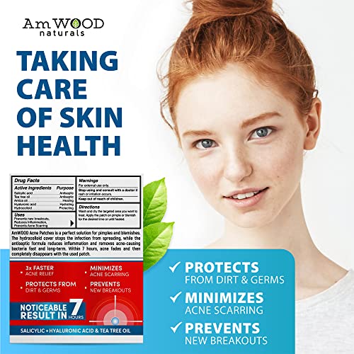 Acne Patches Hydrocolloid Bandages with Salicylic & Hyaluronic Acids
