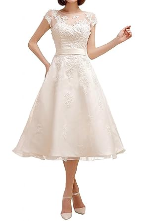 YASIOU Hochzeitskleid Standesamt Damen A Linie Kurz Tüll Spitze Weiß Vintage Durchsichtig Hochgeschlossen Knielang Brautkleid