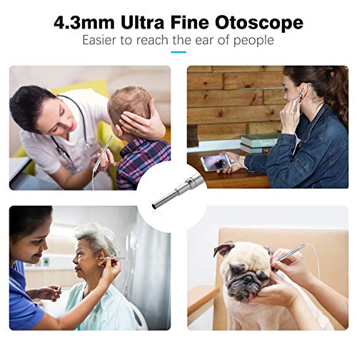 2 Otoscope+Teslong+Wireless+Washable+Speculum