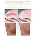 Scar Cream,Scar Removal Cream Gel,Scar Treatment,Scar Repair Cream,Acne Spots Treatment,Scar Gel Remove & Lighten Old & New Scars,Acne Scar Removal Cream,Face Skin Repair Cream