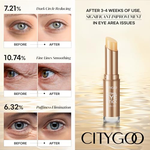 Retinol Eye Stick With Collagen, Hyaluronic Acid For Dark Circle, Wrinkles in 3-4 Weeks, Under Eye Cream Anti Aging, For Puffiness and Bags Reduces Fine Lines (Retinol Premium Gold Edition 3g)