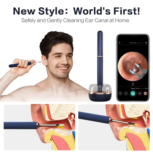 BEBIRD Ear Wax Removal Tool, Fully Upgraded Flagship Model,10 Megapixel