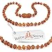 Baltic Amber Teething Necklace, 50% Richer and More Effective, Raw Unpolished Amber Beads - Extra Safe Lab Tested & Certified, Teething Pain & Drooling Reduce Properties /DCGN.U-BRQ / 29.5CM / 11.6IN