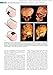 Smith's Recognizable Patterns of Human Deformation