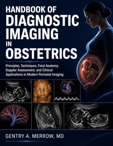 Diagnostic Imaging: Chest: 9780323796637: Medicine & Health