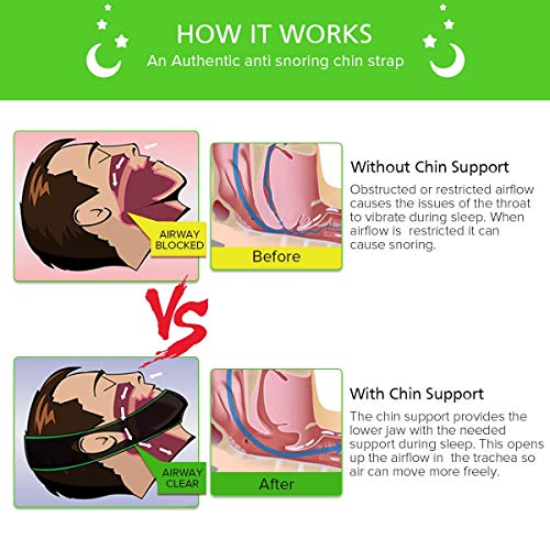 image for AD Snoring Anti Snoring Chin Strap - Premium Snore Stopper Guard for a