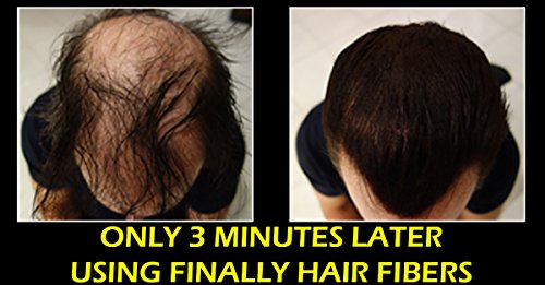 Finally Hair Fiber Lock STRONG Hold Spray for Holding Fibers in Place. Compatible/Replacement For Fi - //medicalbooks.filipinodoctors.org