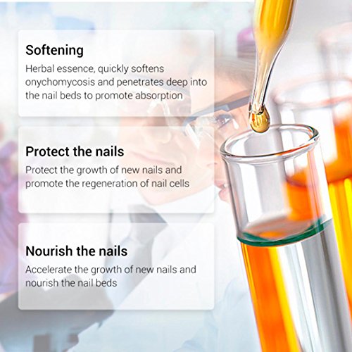 Nail Toenail Fungus Treatment, Fungus Stop Effective Anti Against Nail Fungus Solution Set (15ml)