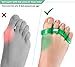Toe Separators - Yoga Massage Ball -for Bunions, Pedicure, Hammertoe - Foot Pain Relief by ProTragen