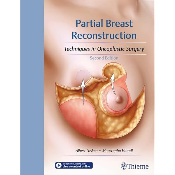 Oncoplastic Breast Surgery: A Guide to Clinical Practice