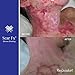 Rejuvaskin Scar Fx Silicone Sheeting - 1.5