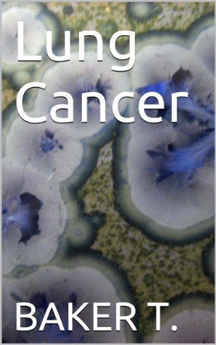 [D.o.w.n.l.o.a.d] Lung Cancer (WHAT YOU NEED TO KNOW Book 5) [Z.I.P]
