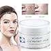 Acne Treatment, Acne Removal Cream, Pimple Treatment, Face Skin Repair Cream, Acne Spots Treatment Cream, Get Rid of acne & Pimples (1oz)