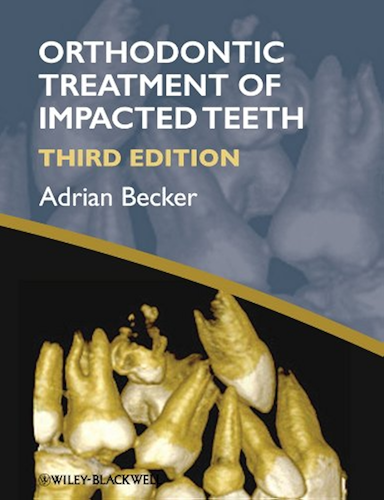 Download Orthodontic Treatment of Impacted Teeth (English Edition) PDF